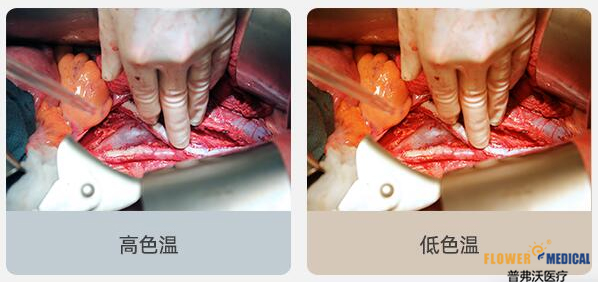 手术无影灯,手术灯,习近平为她点赞